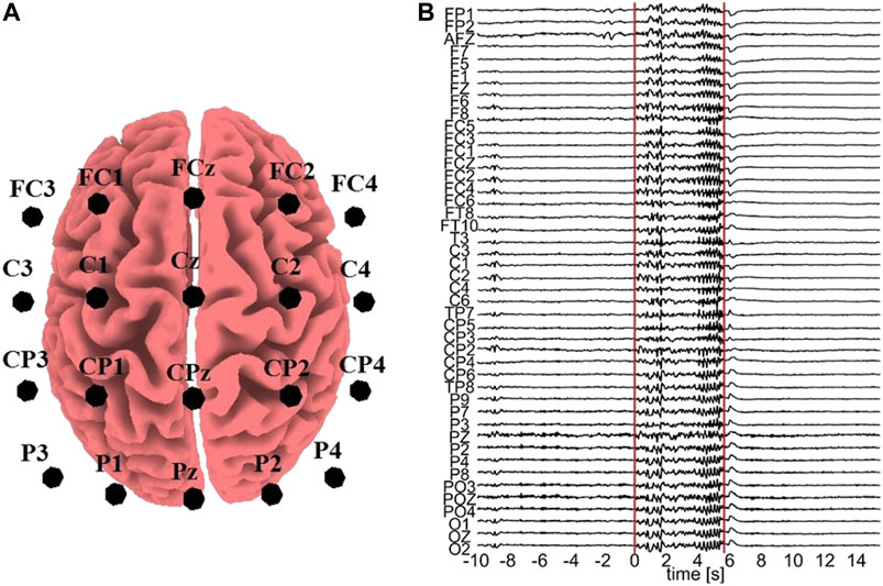 Comparison of Causality Network Estimation in the Sensor and Source Space: Simulation and Application on EEG